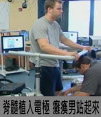 全球首例！脊髓植入電極癱瘓男站起來｜台灣e新聞